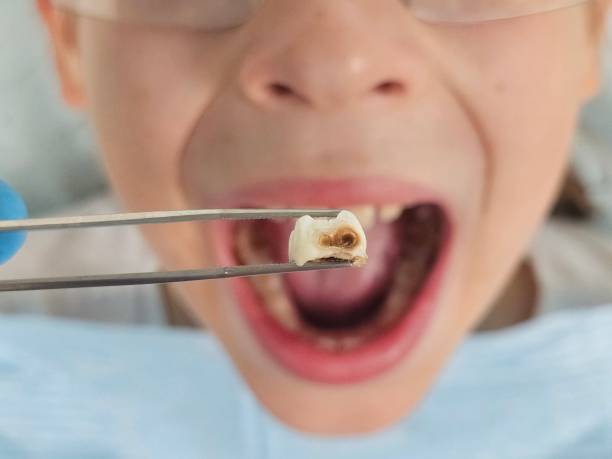 Best Emergency Broken Tooth Repair in Twinsburg, OH