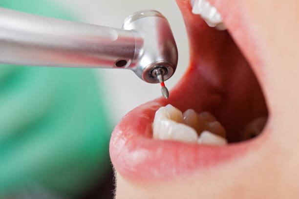 Best Walk-In Emergency Dentist in Twinsburg, OH